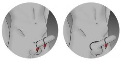 ElectraStim - Prestige Electraloops 2 x Regulowany Cockring (srebrny)