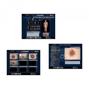 Oprogramowanie Medyczne Photo-Max Program do Analizy Dermatoskopowej (Analiza Dermatoskopowa)