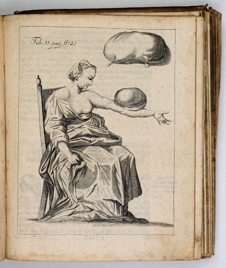 PURMANN Matthäus Gottfried - Matthæi Gothof. Purmanni, Chirurgi und Stadt-Artztes zu Bresslau, Herausgegebene Chirurgia Curiosa, darinnen ein jedweder Chirurgus nicht allein auffs gründlichste sehen und finden kan, was in die gantze Wund-Artzney vor künst