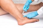 Skleroterapia - sposób na piękne nogi bez żylaków