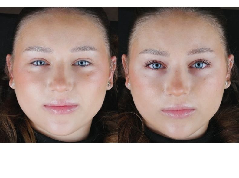 Rarity Hydro Care Step 3-4 (5ml)