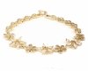 gold bracelet for a gold-plated leg
