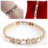 gold bracelet for a gold-plated leg
