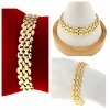 gold bracelet for a gold-plated leg
