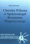 Choroba Wilsona w spektroskopii rezonansu magnetycznego