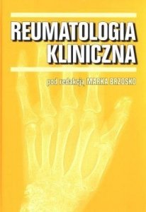 Reumatologia kliniczna M. Brzosko