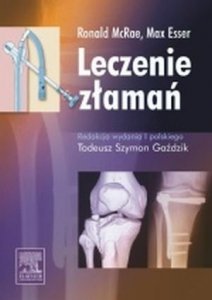 Leczenie złamań
