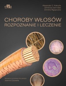 Choroby włosów Rozpoznanie i leczenie