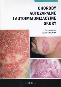 Choroby autozapalne i autoimmunizacyjne skóry