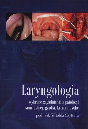 Laryngologia Wybrane zagadnienia z patologii jamy ustnej gardła krtani i okolic