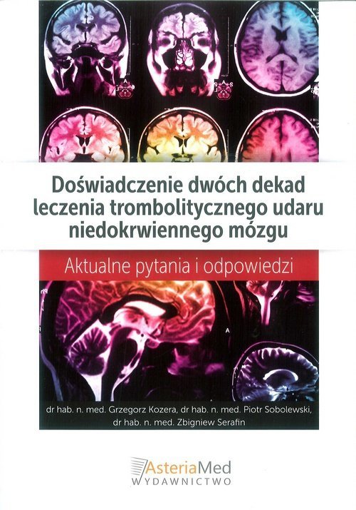 Doświadczenie dwóch dekad leczenia trombolitycznego udaru niedokrwiennego mózgu
