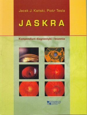 Jaskra Kompendium diagnostyki i leczenia