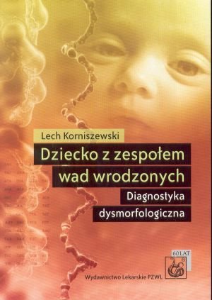 Dziecko z zespołem wad wrodzonych Diagnostyka dysmorfologiczna