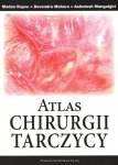 Atlas chirurgii tarczycy