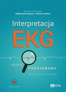 Interpretacja EKG