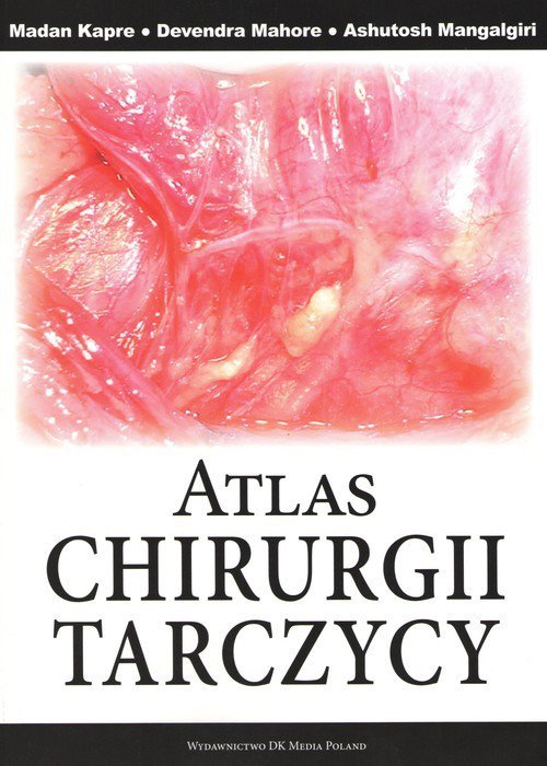 Atlas chirurgii tarczycy