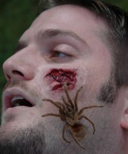 Sztuczna rana - Atak pająka