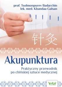 Akupunktura.