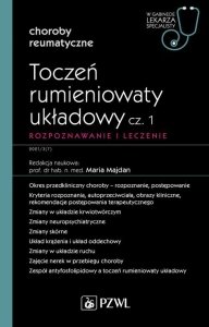 Toczeń rumieniowaty układowy Część 1 Rozpoznawanie i leczenie