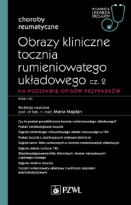Obrazy kliniczne tocznia rumieniowatego układowego. Na podstawie opisów przypadków. Reumatologia. Cz