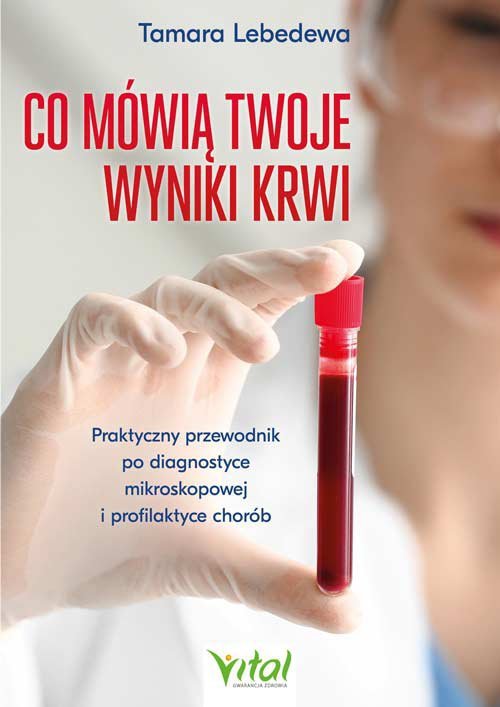 Co mówią twoje wyniki krwi