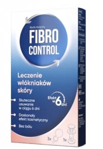 Fibrocontrol, zestaw do usuwania włókniaków