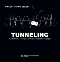 TUNNELING Kompleksowa koncepcja chirurgii plastycznej przyzębia 