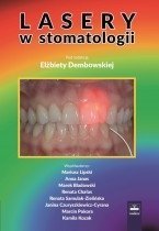 Lasery w stomatologii