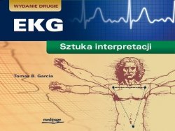 EKG sztuka interpretacji. Wydanie 2