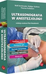 ULTRASONOGRAFIA W ANESTEZJOLOGII