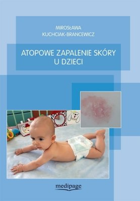 Atopowe zapalenie skóry u dzieci 