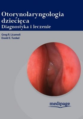Otorynolaryngologia dziecięca. Diagnostyka i leczenie