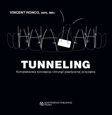 TUNNELING Kompleksowa koncepcja chirurgii plastycznej przyzębia 