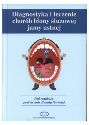 DIAGNOSTYKA I LECZENIE CHORÓB BŁONY ŚLUZOWEJ JAMY USTNEJ