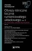 Obrazy kliniczne tocznia rumieniowatego układowego Część 2 