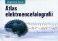 Atlas elektroencefalografi<br />i 
