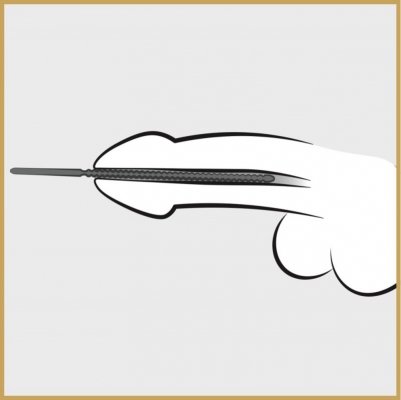 Dilator śr. 6mm