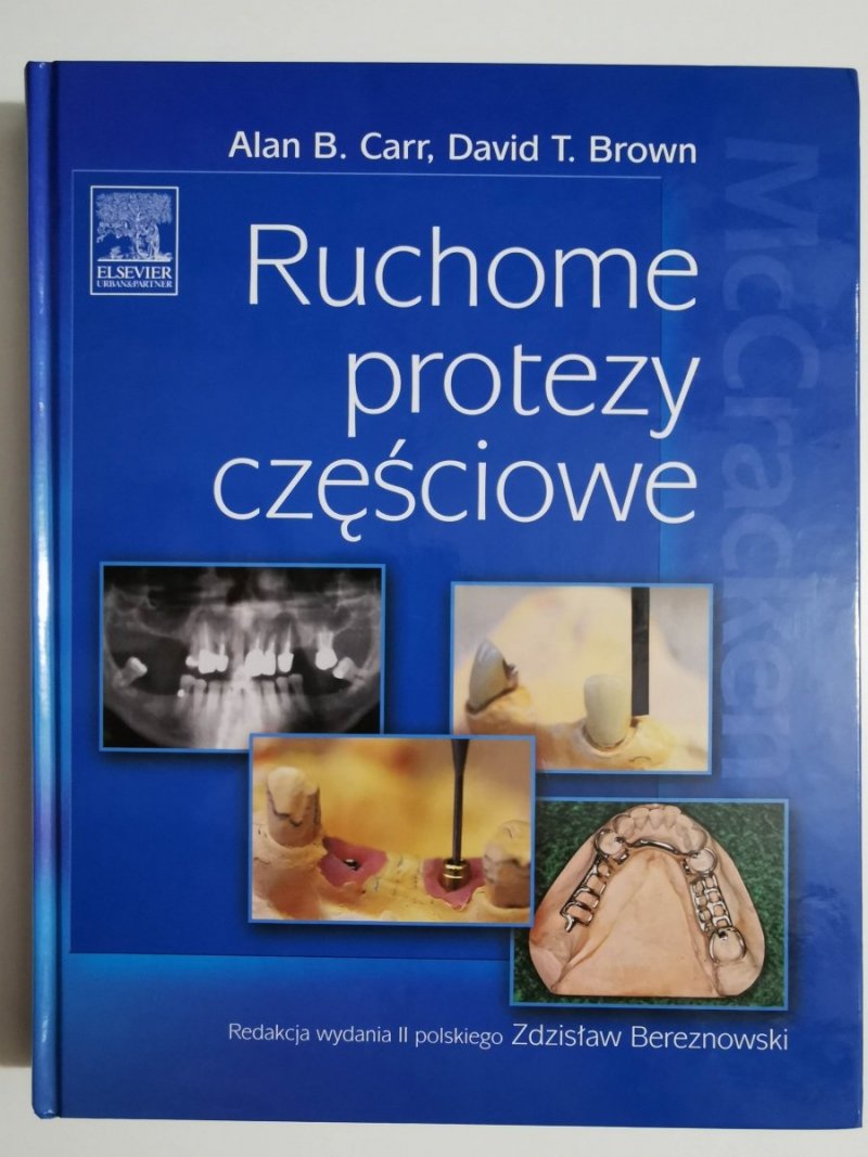 Ruchome protezy częściowe - Alan B. Carr, Dawid T. Brown
