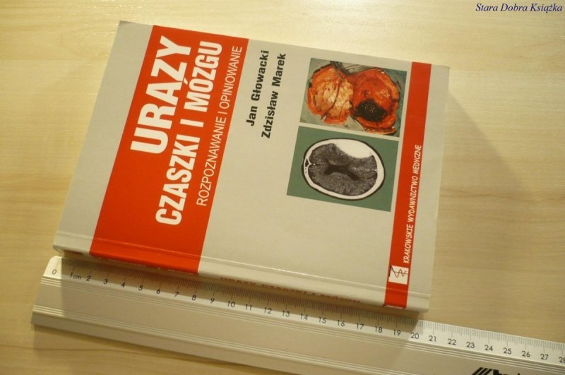 URAZY CZASZKI I MÓZGU. ROZPOZNAWANIE I OPINIOWANIE