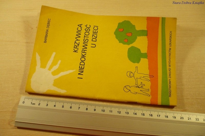 KRZYWICA I NIEDOKRWISTOŚĆ U DZIECI - Dębiec (1980)