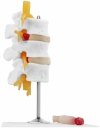 Odcinek lędźwiowy z przepukliną kręgosłupa - model anatomiczny Physa  PHY-SM-6 10040324 4062859971579