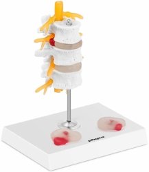 Odcinek lędźwiowy z przepukliną kręgosłupa - model anatomiczny Physa  PHY-SM-6 10040324 4062859971579