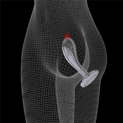 Flawless Clear Prostate Plug 6.0&#039;&#039;